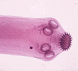 scolex of a tapeworm